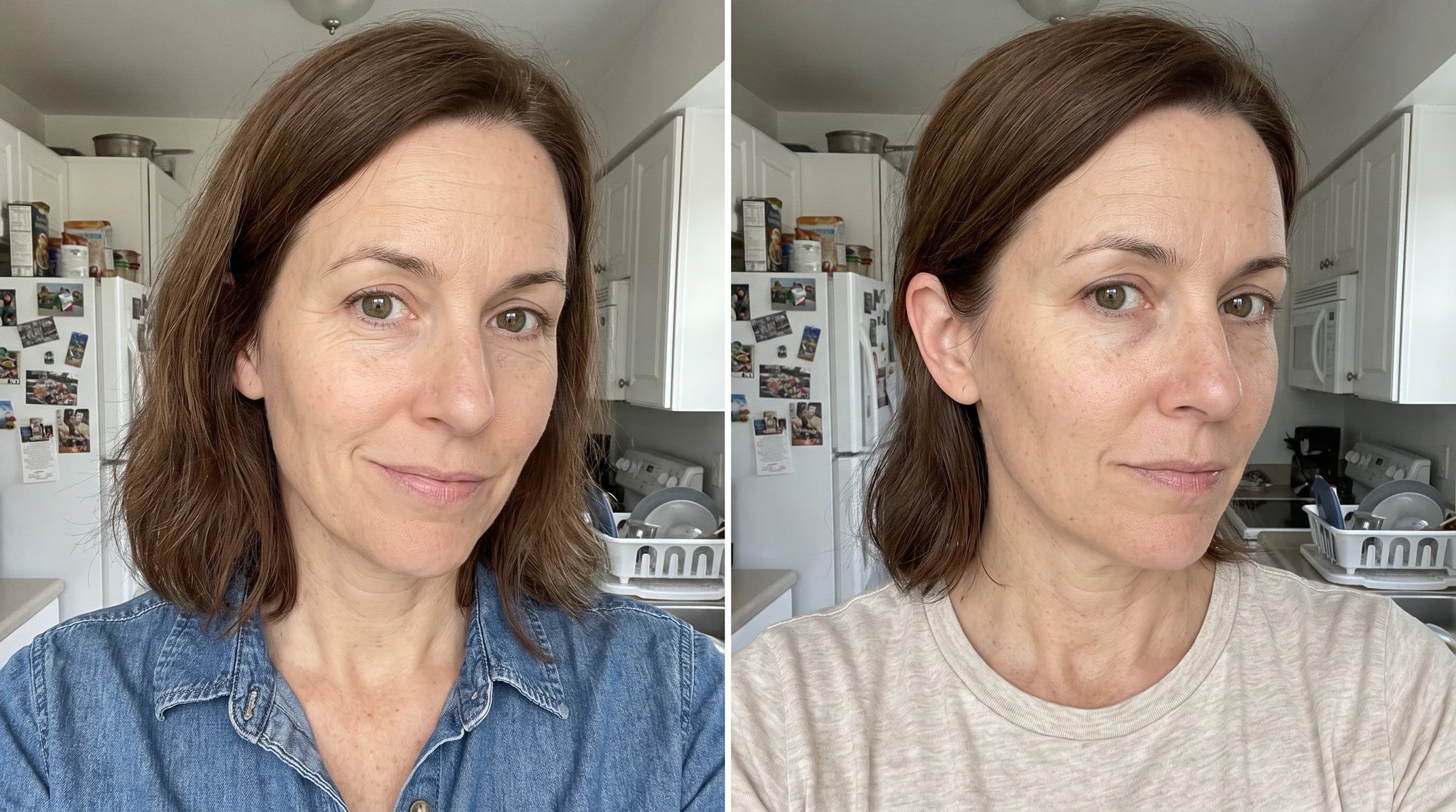 Illustrative after portrait of the same woman, with natural fine lines
