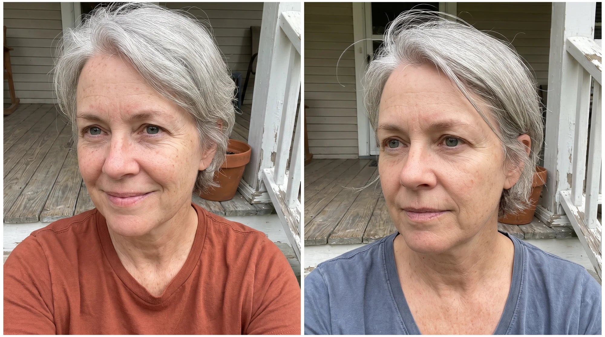 Illustrative after portrait of the same woman, with natural fine lines